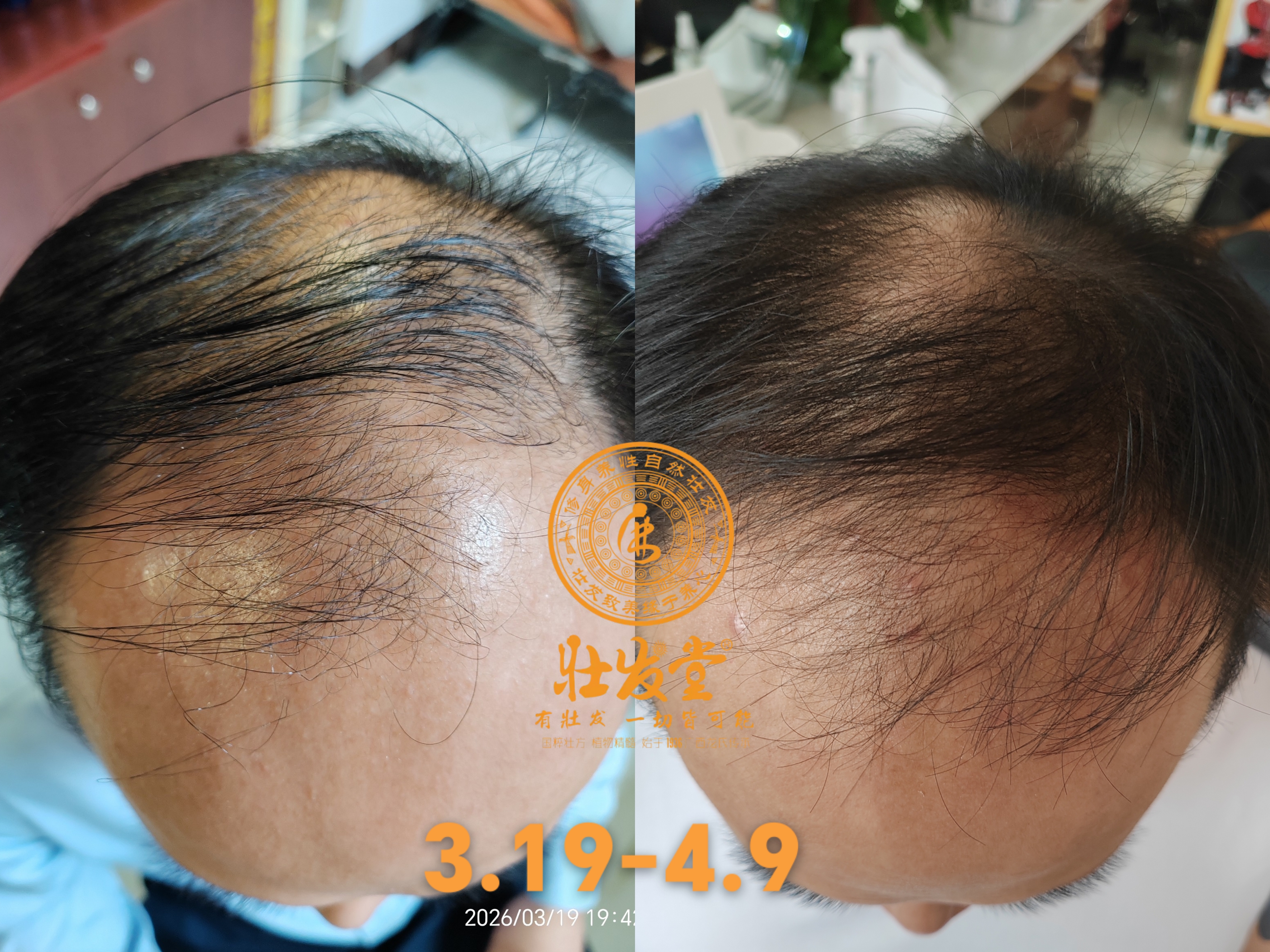 脱养密不到一个月的效果