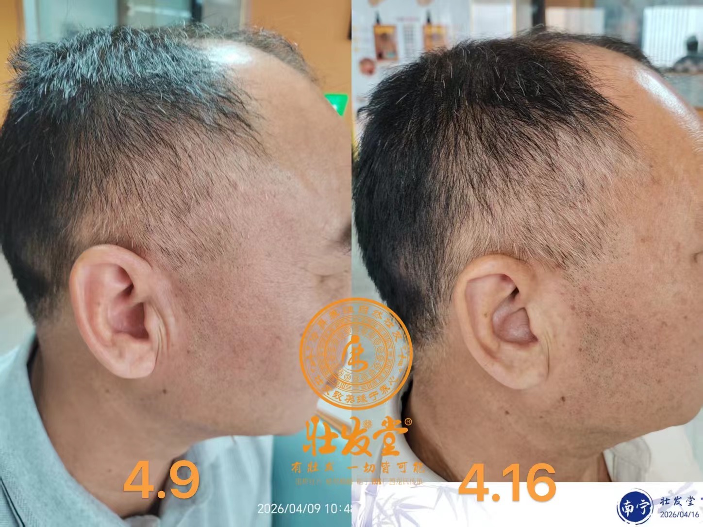 养发一个星期的效果